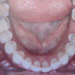 2 Immagine intraoral